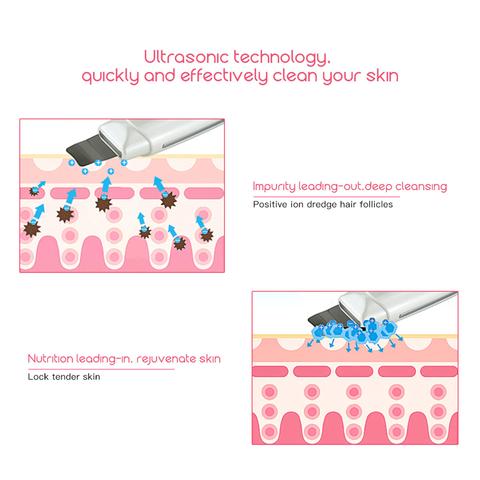 Ultrasonic Skin Scrubber Face Cleanser Blackhead Acne Removal Facial Spa Vibration Massager